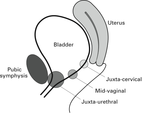 What Causes Pain In Arm And Shoulder What Causes Pain In Arm And Shoulder